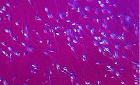 Baisse de 50% pour la fertilité masculine