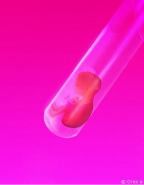 Limiter le recours aux procréations médicalement assistées en Belgique ?