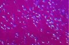 Peu de contrôle dans la pratique du don de sperme : anonyme ou pas ?