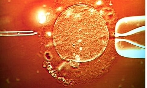 Cardio 3 : des cellules souches adultes pour régénérer le coeur fragilisé