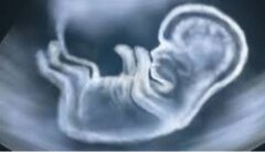 Luxembourg : l’avortement ne devrait plus être justifié par une situation de détresse