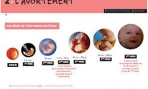 Chili : repénaliser l’avortement n’entraîne pas une hausse de la mortalité maternelle
