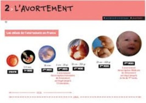 Chili : repénaliser l’avortement n’entraîne pas une hausse de la mortalité maternelle