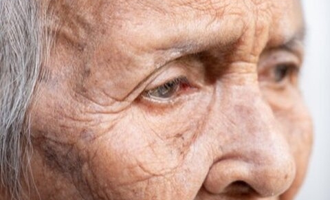 Belgique : Le Conseil supérieur de la santé pour une prise en charge intégrale des patients déments