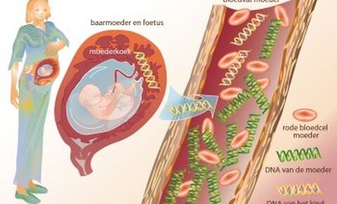 Belgique : rembourser les diagnostics prénataux non invasifs (DPNI) pour déceler la Trisomie 21