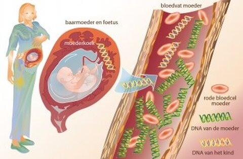 Belgique : rembourser les diagnostics prénataux non invasifs (DPNI) pour déceler la Trisomie 21