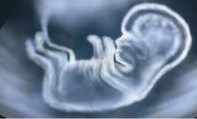 CEDH : droit à la vie de l'enfant à naître