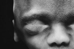 Un gynécologue ose qualifier l’avortement comme étant un homicide