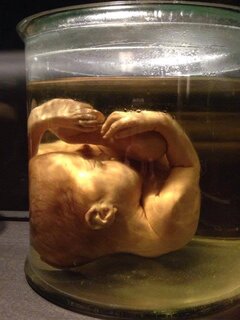 A propos de l'utilisation de fœtus avortés pour la recherche