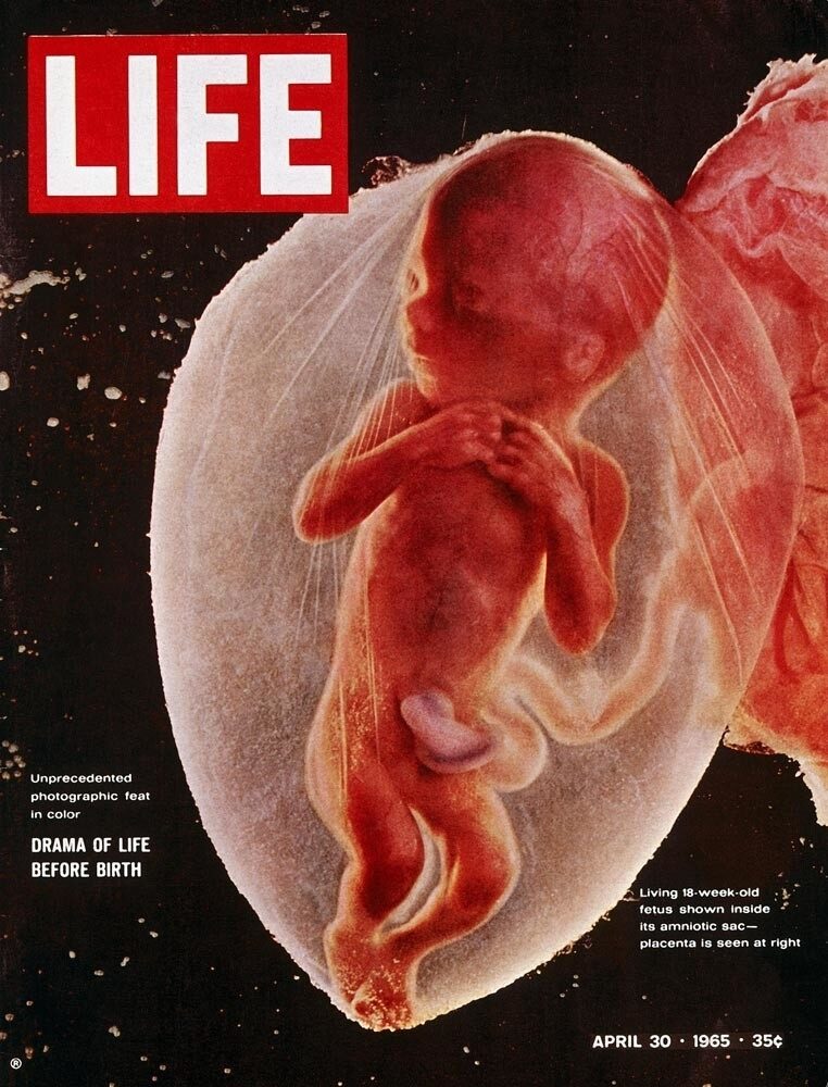 Foetus de 4 mois (photo) : une majorité politique s'apprête à en autoriser l'avortement