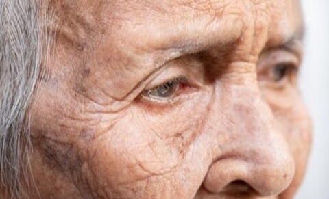 Vers l’euthanasie des personnes démentes sans leur consentement verbal ?