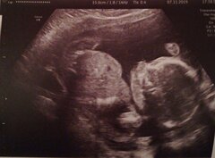 Wat de deskundigen in 2018 echt hebben gezegd over de huidige voorstellen over abortus...