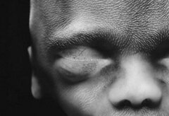 Yara a obtenu que son bébé avorté soit reconnu comme une personne