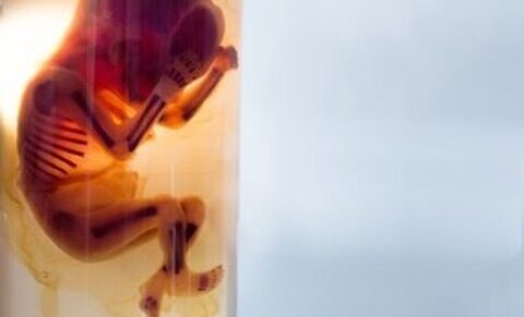 Het gebruik van geaborteerde foetussen om een Covid-19 vaccin te vinden?