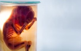 Het gebruik van geaborteerde foetussen om een Covid-19 vaccin te vinden?