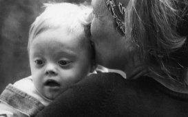 Doet de geboorte van kinderen met het syndroom van Down "het lijden van de wereld" toenemen?