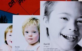 Stijging van abortussen bij kinderen met het syndroom van Down sinds de terugbetaling van de NIPT-test