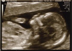 Le fœtus pourrait ressentir la douleur dès la 13ème semaine de grossesse