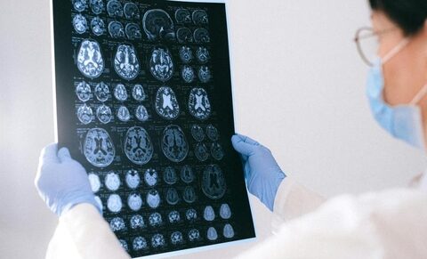 Alzheimer : prédire l’apparition de la maladie pour mieux la traiter
