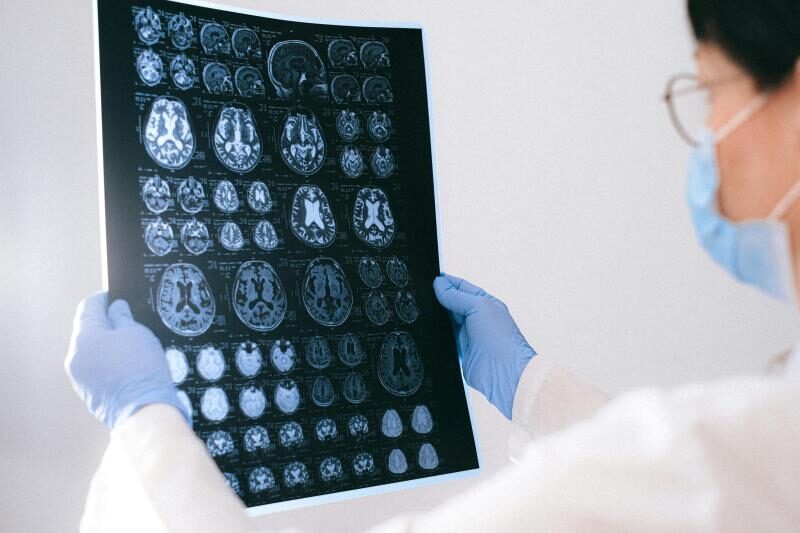 Alzheimer's: predicting the onset of disease to improve treatment