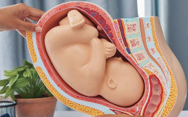 Between hope and organ shortage, uterus transplants raise ethical questions