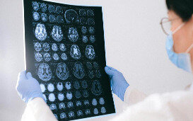 Een betere voorspelling van Alzheimer geeft zicht op een betere behandeling