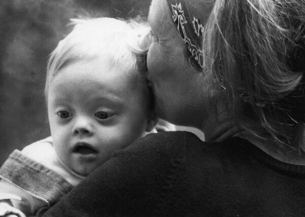 Préjudice d'être né, naissance handicapée