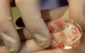 Is IVF (ART) indisputable?