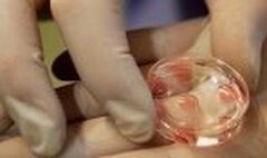 Is IVF (ART) indisputable?