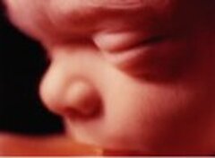 Abortus: 28 jaar wetstoepassing in België